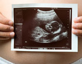pregnant woman holding ultrasound